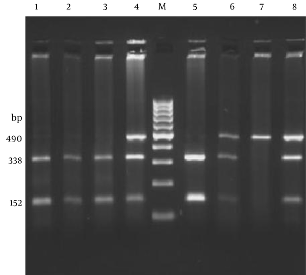Polymerase chain reaction-restriction fragment length polymorphism analysis of the C47T polymorphism (Rs4880) in the SOD2 gene using 2.5% agarose gel electrophoresis. A single fragment of 490 bp indicates a C/C genotype, two fragments of 338 and 152 bp indicates the T/T genotype and the appearance of all three bands represents the heterozygous C/T genotype. Lanes 1, 2 and 3 show the T/T genotype; lanes 4, 6 and 8 show C/T genotypes and lane 7 shows C/C genotype.  Lane M is a 100-bp DNA ladder.