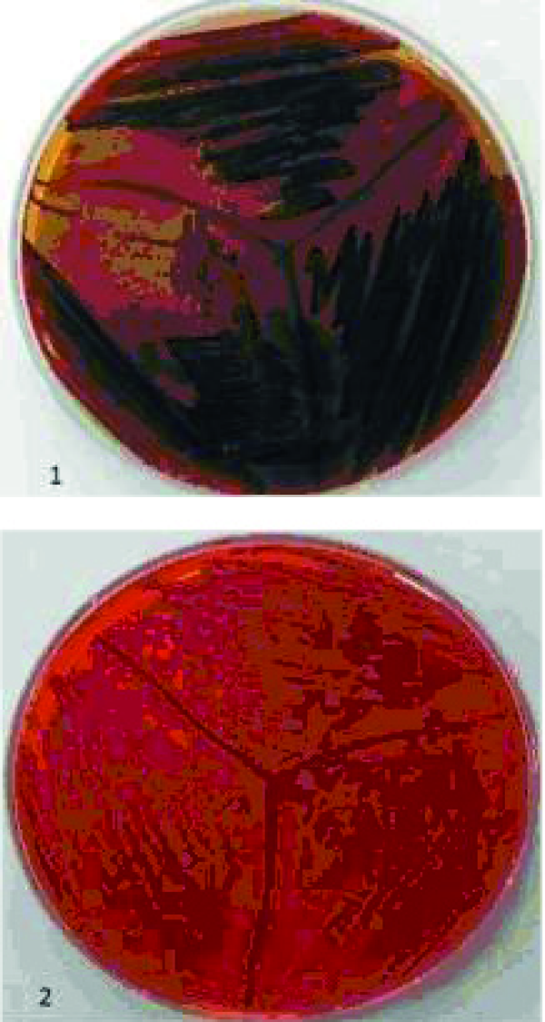 Black Colonies (1) on CRA Show Slime Layer Producer MRSA and red Colonies (2) Illustrate non-Slime Layer Producer MRSA