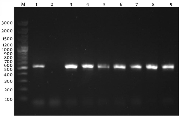 Lane M: Gene ruler, 100 bp DNA ladder plus marker (Fermentas, Germany); Lane 1: positive control of amplified 518-bp DNA (S. aureus ATCC 29213); Lane 2: negative control (reaction mixture without DNA); Lanes 3 - 9: representative S. aureus nasal isolates positive for the blaZ gene.
