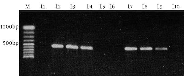 M, 100bp DNA ladder (Vivantis, Malaysia); L1, negative control (distilled water); L2, tet (O) positive control (JX853721); L3, L4, L7, L8 and L9, tet (O) positive samples; L5, L6 and L10, tet (O) negative samples.