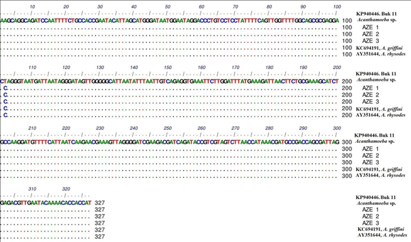 Nucleotide Sequence Alignment of 18S rRNA Gene Based on Detected Novel and Common Haplotypes in this Study Compared to Retrieved Sequences From GenBank Database