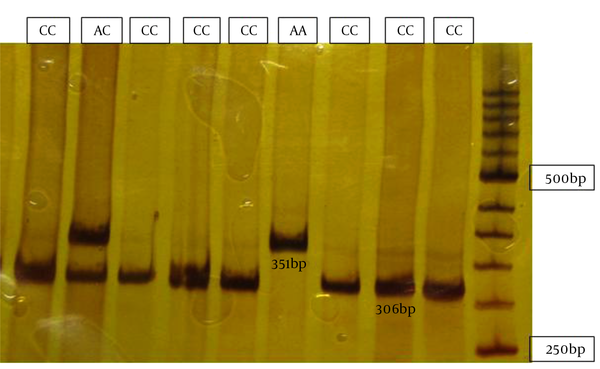 Polyacrylamide Gel Electrophoresis of MIR17HG PCR Products Digested With Alu1 Restriction Enzyme, 50 bp DNA Marker
