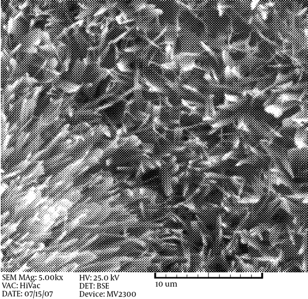 Surface Morphology of HA Coating With Applied Potentials of 3 V Formed on Stainless Steel 304