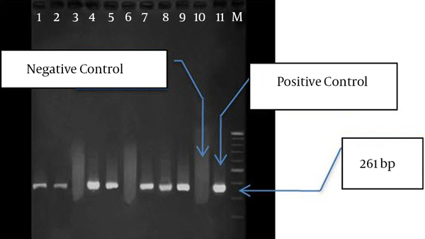 Lanes: M: 100 bp Marker, 11: Positive Control, 1 to 9: PCR Product for VIM-1 Gene,10: Negative Control.