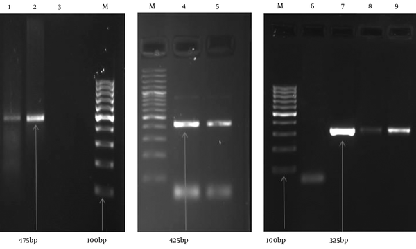 M, DNA ladder (100 bp); 1, positive HPV45 DNA sample (475 bp); 2, positive control HPV45 DNA (475 bp); 4, positive control HPV18 DNA (425 bp); 5, positive HPV18 DNA sample (425 bp); 7, positive control HPV16 DNA (325 bp); 8 &amp; 9, positive HPV16 DNA sample (325 bp); 3 &amp; 6, negative control.