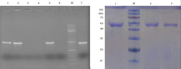 A) PCR analysis of the appA integration in P. pastoris chromosome. Lanes 1 - 5: colony-PCR on transformed colonies. Lane 6: P. pastoris with pPinkα-HC as a negative control. Lane M: DNA marker, lane 7: pPinkα-appA plasmid as a positive control. B) SDS-PAGE analysis of the recombinant phytase from P. pastoris. Lane M: protein molecular marker. Lane 1, 2 and 3: samples of phytase expression from culture supernatant at 48, 36 and 24 hours induction, respectively.