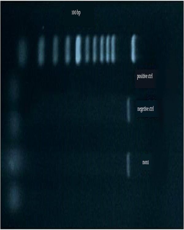 Gel Electrophoresis of the Polymerase Chain Reaction Products Using nan1 Gene-Specific Primers