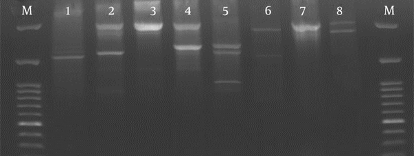 Representative BOX-PCR Patterns for Isolates with PI-1 of S. Pneumoniae Performed with Box A Primer