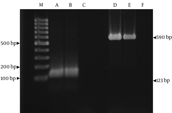 A: Clinical sample of M. tuberculosis. B and C: Positive and negative controls. D: Clinical sample of Nocardia. E and F: Positive and negative controls. M; 100 bp DNA size marker