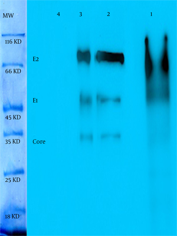 (1) Recombinant protein before PNGase F and it is Smear like and heavy with N-glucan bands; (2) recombinant protein after PNGase F without extra N-glucan linkages and sharp bands; (3) HCV proteins as positive control; (4) negative control; MW is molecular weight markers.