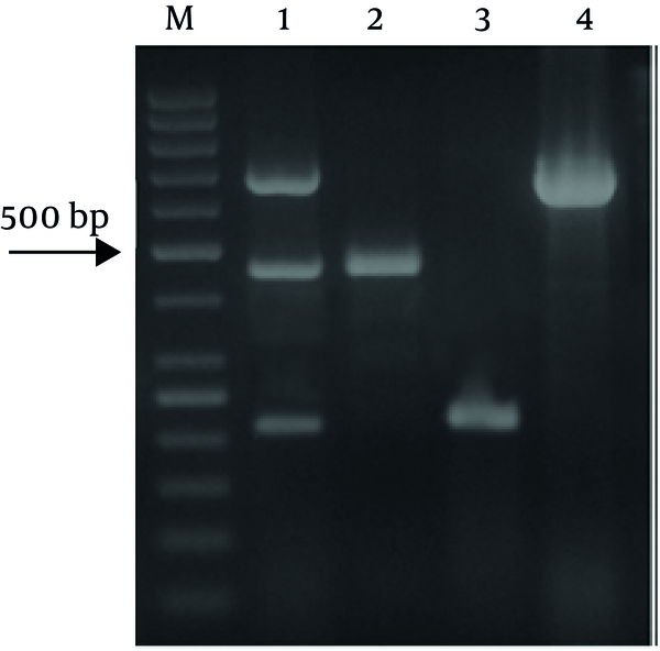 M: 50 bp DNA ladder, 1: Multiple pathogen, 2: L. monocytogenes ATCC 7644, 3: E. coli O157:H7 ATCC 43895, 4: Salmonella Typhimurium ATCC 35987