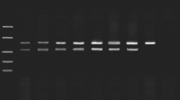 M: SM1108 DNA ladder (MBI Fermentas, USA) Lane 1, positive control, Lane 2, 1000000 copies/mL, Lane 3, 100000 copies/mL, Lane 4, 10000 copies/mL, Lane 5: 5000 copies/mL, Lane 6, 2500 copies/mL, Lane 7: 500 copies/mL, Lane 8:50 copies/mL, Lane 9: negative control. Lane 2-8 contains 103 copies of IAC plasmids.
