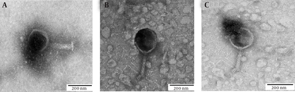 Transmission Electron Micrographs of the Purified MJ1 Phage; Scale Bars, 200 nm
