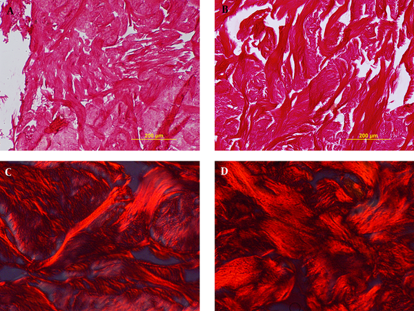 Verifying collagen density via picrosirus red staining with light microscope (A, B) and polarizing microscope (C,D). Sections show no difference before decellularization (A,C) and after it (B,D).
