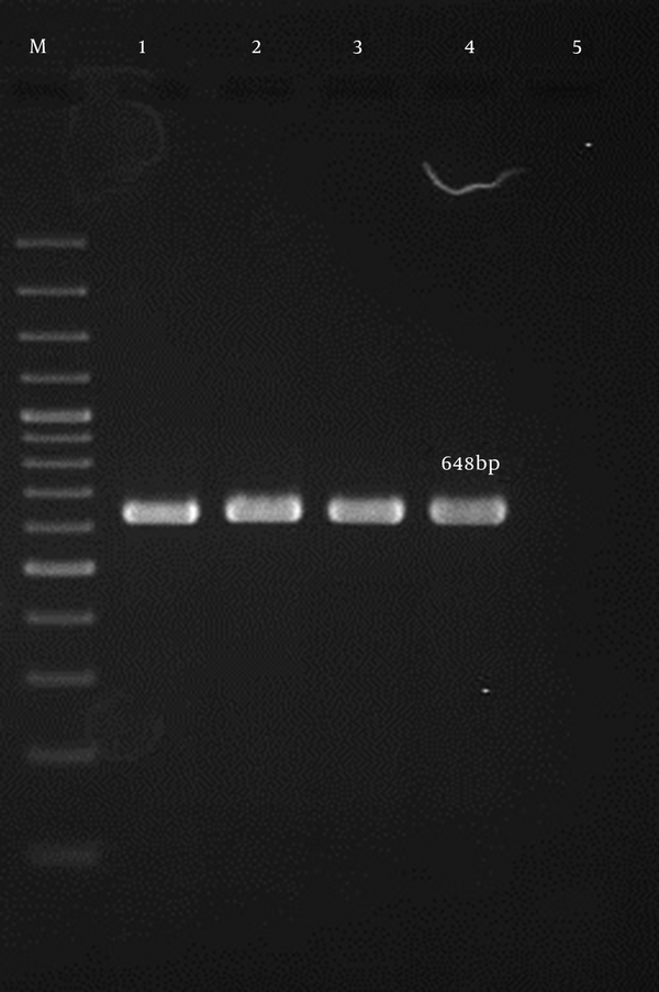 Lane M, 100-bp DNA ladder (Fermentas, UK); lane 2 - 4, the 648-bp PCR product of femA; lane 1, the positive control; lane 5, the negative control.