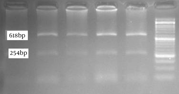 The Results of HahI Digestion for the Detection of p.R390H