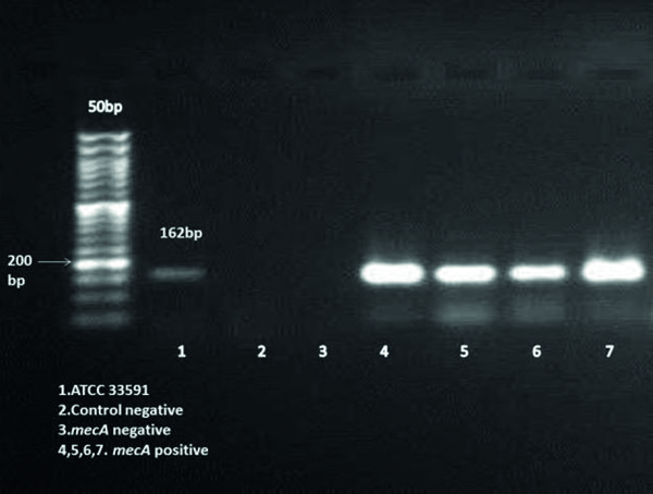 Gel Electrophoresis of the PCR Amplification Using mecA Gene Specific Primers