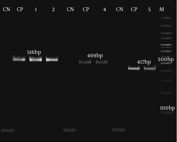 Lanes 1 and 2 display a 516 bp fragment of the qnrA gene. Lane 4 displays a 469 bp fragment of the qnrB gene. Lane 5 displays a 417 bp fragment of the qnrS gene. Lane M represents the 100 bp DNA ladder. Lane NC: negative control. Lane PC: positive control.
