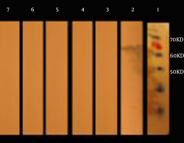 Lane 1, protein marker; Lane 2, Western blotting using the patients’ samples (positive control); Lane 3 - 7, Western blotting using normal human sera (negative control).