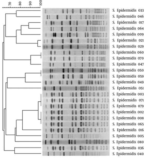 Pulsed-Field Gel Electrophoresis Dendrogram of Twenty-five Methicillin-resistant Staphylococcus epidermidis Isolates Recovered From the Intensive Care Unit ward of Al-Zahra Hospital, with a 90% Similarity Cut-Off Point Clustered by Unweighted Pair Group Method with Arithmetic Mean