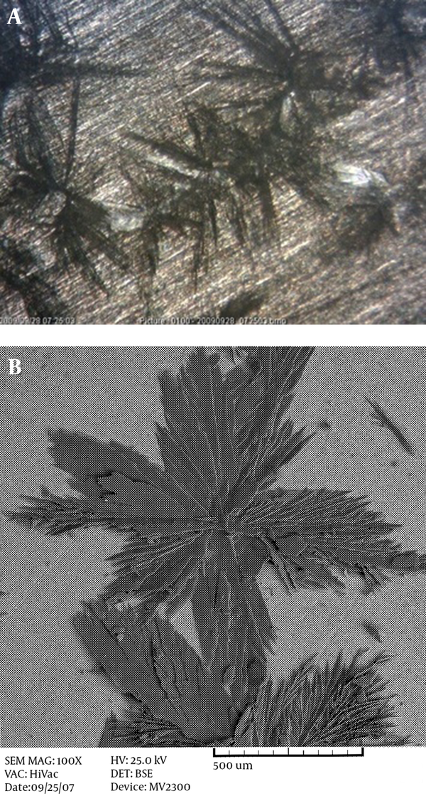 Surface Morphology of HA Coating With Applied Potentials of 2 V Formed on AZ31 Magnesium Alloy, Seen With Optical Microscopy (A), and Stainless Steel 304, Seen With SEM (B) at Room Temperature