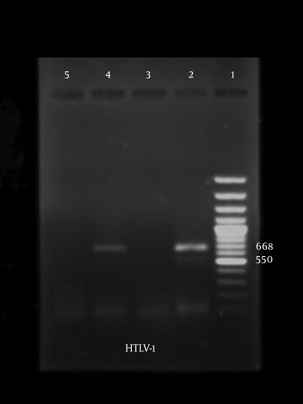 A 668 bp fragment was amplified from the pol region of HTLV-Ι genome. Lane 1, 100 bp marker; lane 2, positive control (TL-Oml); lane 3, negative sample; lane 4, positive sample; lane 5, negative control.