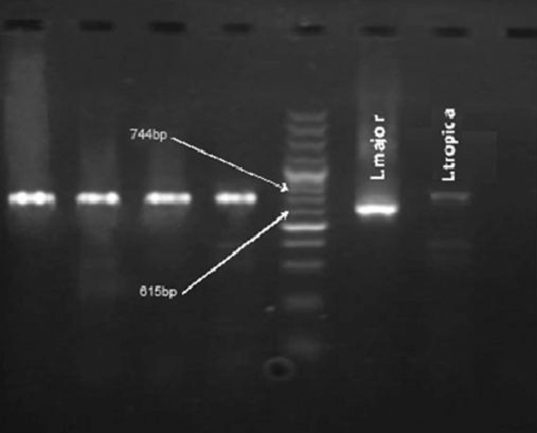 Columns: 1, negative control; 2, positive control for L. Tropica; 3, positive control for L. major; 4, 100 bp DNA Ladder; 5 - 8, Patients’ samples.