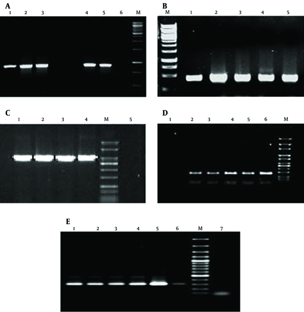 A) PCR amplification of integrase gene (int) of class 1 integron; lanes 1-4: int+ isolates, lane 5: positive control, lane 6: negative control. B) PCR amplification of eae gene; lanes 1-4: eae+ isolates, lane 5: positive control. C) PCR amplification of ipaH gene; lanes 1-3: ipaH+ isolates, lane 4: positive control, lane 5: negative control. D) PCR amplification of hilA gene; lanes 3-6: hilA+ isolates, lane 2: positive control, lane 1: negative control. E) PCR amplification of 16s-23s intergenic spacer region of V. cholerae; lanes 2-6: positive isolates, lane 1: positive control, lane 7: negative control.