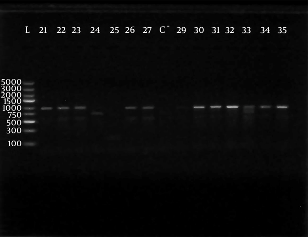 L lane, molecular weight marker; Gene Ruler 100 - 5000 bp DNA ladder, lanes numbered 16,17, 18, 19, 20, 21, 23, 24 and 25 show (1007 bp) bands of PCR products, lanes numberd 26, 28, 29 show negative results, while lanes C+ and C- show positive and negative controls respectively.