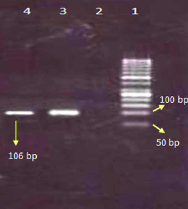 Lane 1: 50-bp DNA size marker, Lane 2 negative control, Lane 3 positive control, Lane 4: positive sample influenza type