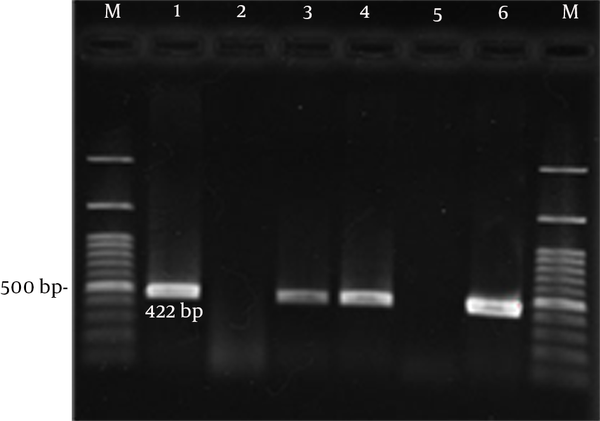 M; 100 bp marker, 1; positive control, 2; negative control, 3,4; positive samples for 16srRNA PCR.