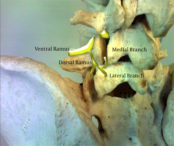 Lumbar Spine Anatomy Showing the Medial Branches