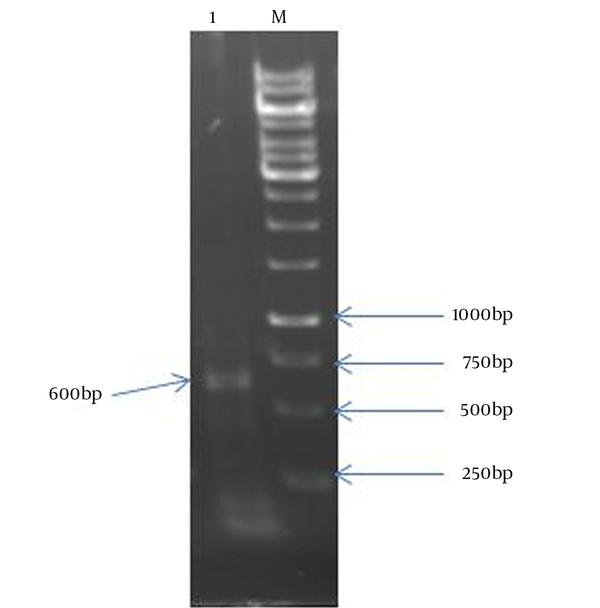 Lane 1: a 600 bp fragment of HBHA; Lane M: 1 kb DNA size marker.