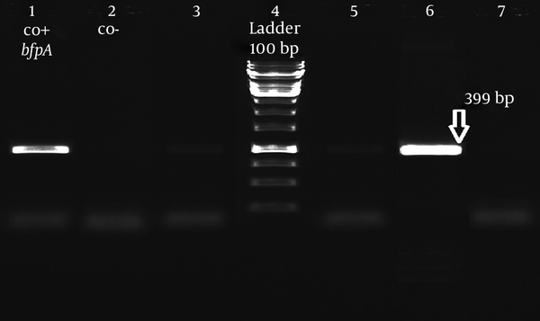 Lane 1, bfpA positive control E. coli E2348.69; lane 2, negative control; lanes 4, 100 bp DNA ladder (Fermentase, Germany); lane 6: positive E. coli isolates.