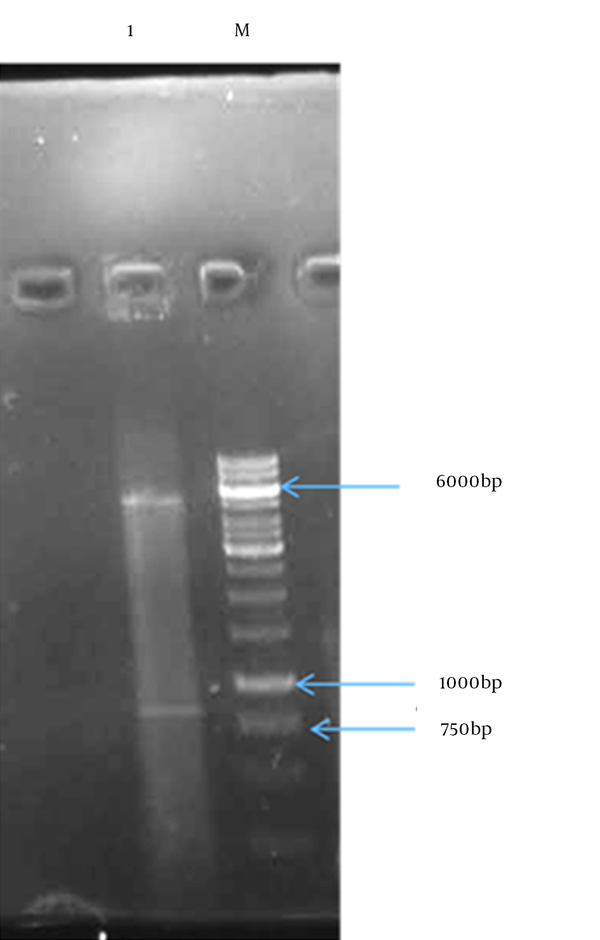 Lane1: vector and Mtb32C-HBHA fusion gene; M: 1 kb DNA size marker.