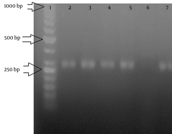 Gel Electrophoresis of the Polymerase Chain Reaction Products From Tcpa Gene