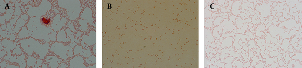 Microscopic images under camera light microscopy (Digital DP 72-BX 51, Olympus, Japan) showing pure bacilli form at 24 hours incubation (1A), mixed forms, bacilli, U-shapes and elongated bacilli after exposure to antibiotics (1B) and pure induced coccoid bacteria after 8 days (1C).