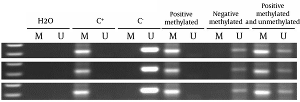 The presence of a visible PCR product in those lanes marked U indicates the presence of unmethylated genes; the presence of a product in those lanes marked M indicates the presence of methylated genes. Lane 1 indicates the 50 base pair DNA size marker. Universal methylated DNA (UMD), unmethylated lymphocytes (lymphocytes) DNA and H2O were used as positive and negative controls, and NTC respectively.