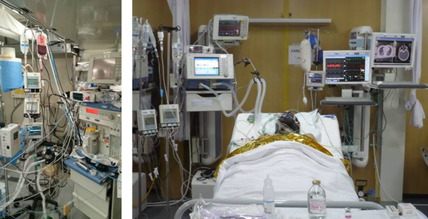 Left, Anesthesia Material and Devices; Right, Box in Intensive Care Unit