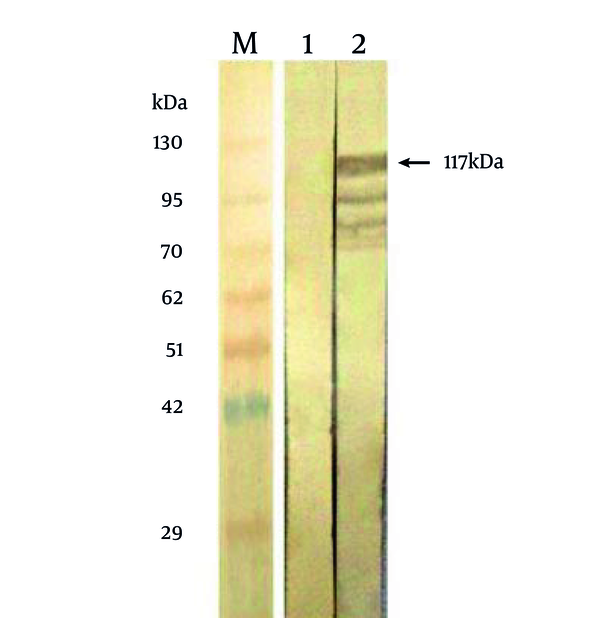 Lane M indicates a prestained protein molecular weight marker (Vivantis, Malaysia). Lanes 1 and 2 represent the reactivity of the positive serum with bacteria expressing MBP and MBP-NS3, respectively.