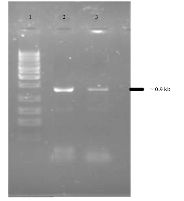 Lane 1, 1kb DNA ladder marker; lane 2 and 3, PCR product of NS3 fragment, which was 902 bp in size.