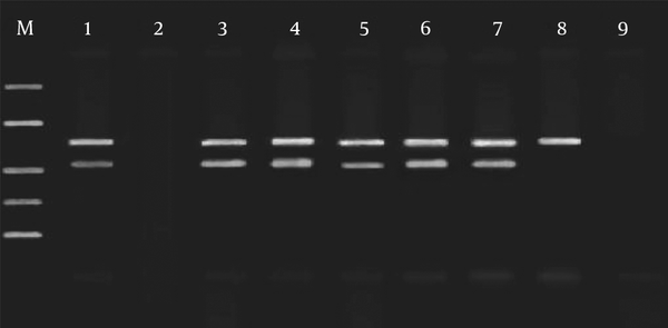 M: SM1108 DNA ladder (MBI Fermentas, USA); Lane 1: positive control; Lane 2 to lane 5: CSF specimens; Lane 2: inhibited CSF specimens; Lane 6 to lane 8: keratitis specimens (lane 8 is true-negative result); Lane 9: negative control. Lane 2-8 contains 103 copies of IAC plasmids.