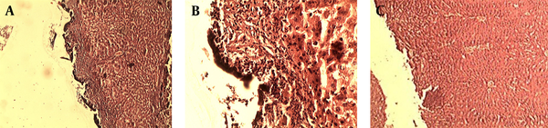 Pathological Effect of Ferric Chloride and Suturing Technique on the Liver Tissue
