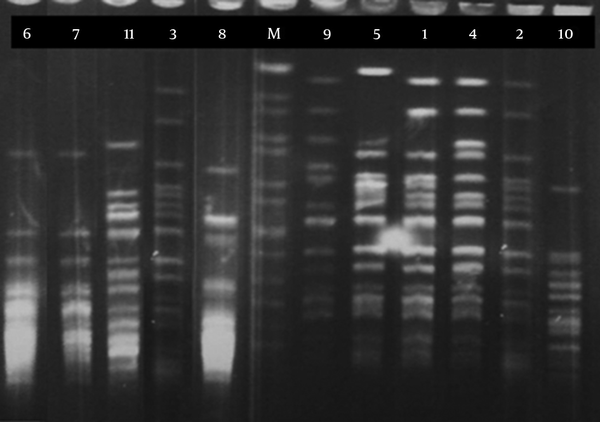 Lane M, genomic pattern of SalmonellaBraenderup H9812 as a marker.