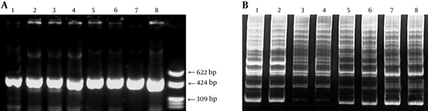 PCR fragment of S. mutans were 517 bp; AP-PCR patterns were to compare the fingerprints.