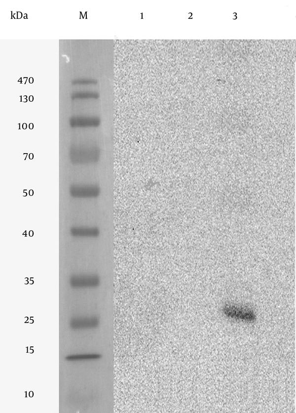 Lane M, Prestained Protein Ladder; Lane 1, untransfected CHO cells; Lane 2, transfected CHO cells with empty pVAX1 plasmid; Lane 3, transfected CHO cells with pVAX1-SAG1 expression plasmid; a protein band about 30 kDa corresponding to SAG1 protein is detected.