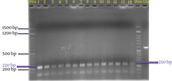 Results of the 14 Isolates Were Digested With Enzymes MboІ 2% Agarose gel Electrophoresis, Wm Represents the Molecular Weight Marker of 50 bp and Un Digest is Indicative