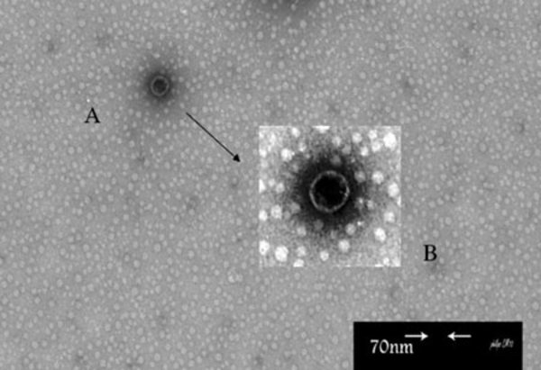 (A) Amplified Picture With High Resolution (B) An Envelope is Seen Around The Phage. This phage was propagated on P. putida Strain Sda2 by Overnight Incubation at 28°c. The Phage Suspension was concentrated by lyophilization, passed Through 0.22 μm Cellulose Acetate Filter, and Prepared for Electron Microscopy by Uranyl Acetate Staining.