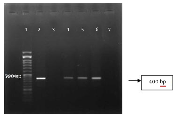 Lane 1, DNA ladder 50 bp, lane 2 and 3, positive and negative controls; lane 4-6, positive samples, lane 7, negative sample.
