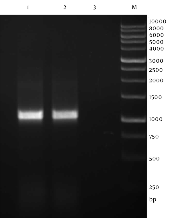 Line 1, 2, 1020 bp PCR product; Line 3, negative control; Line M, 1kb DNA ladder.